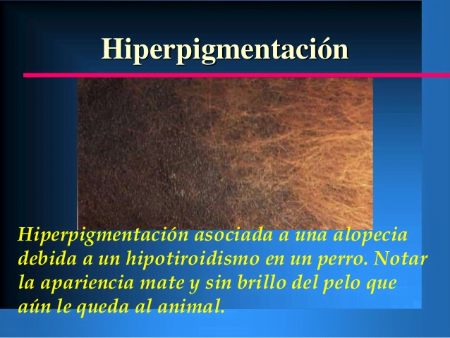 Hiperpigmentación: Oscurecimiento de la piel, producido por exceso de Melanina.
