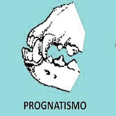 Mandíbula inferior que sobresale de la superior. Prognatismo